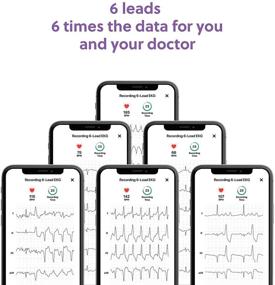 img 3 attached to 🫀 Stay Heart-Healthy at Home with AliveCor KardiaMobile 6L Personal EKG Device: Detect AFib and PVCs, 6 Arrhythmia Detections, Get KardiaCare for 1 Year!