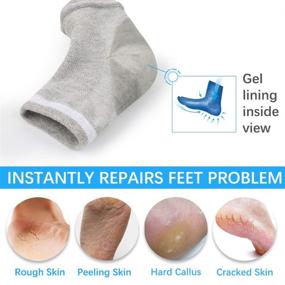 img 1 attached to 🧦 Moisturizing Socks for Dry Cracked Heels - Gel Heel Socks with Open Toe, Ventilate Gel Spa Socks Infused with Vitamins - 3 Pairs (Pink, Turquoise, Grey)