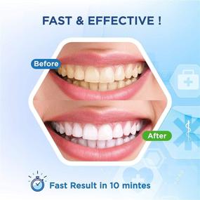 img 3 attached to 🦷 BeriWhite Teeth Whitening Kit: Fast & Painless 20-Minute Stain Removal with Desensitizing Gel & Whitening Gels