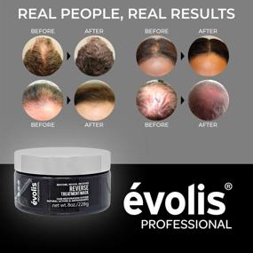 img 1 attached to 💆 évolis REVERSE Hair Mask - Growth Treatment, Deep Conditioning & Repair - for Color Treated Hair (8.5 fl oz)