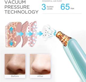 img 3 attached to 🌿 Revolutionize Your Skincare Routine with the Upgraded Blackhead Remover Pore Vacuum Cleaner - USB Electric Facial Pore Cleaner with 5 Probes and LED Display - Green Blackhead Suction Tool - Perfect Blackhead Remover Kit!