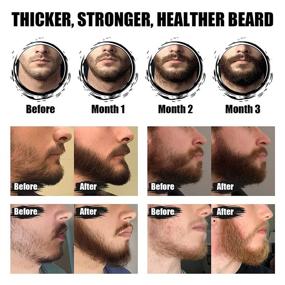 img 3 attached to 🌱 Maximize Beard Growth: Beard Growth Oil Kit with Castor Oil Serum for Fuller, Thicker, Stronger Facial Hair Growth – 2 Pack