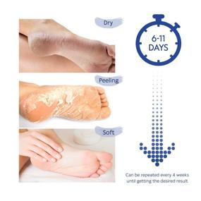 img 2 attached to Aliceva Foot Peel Mask - Advanced Exfoliating Treatment, Callus and Dead Skin Remover - 2 Pairs