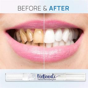 img 2 attached to 😁 VieBeauti Teeth Whitening Pen (2 Pack) - 20+ Uses, Effective, Painless, No Sensitivity, Travel-Friendly, Easy to Use - Achieve a Beautiful White Smile with Natural Mint Flavor