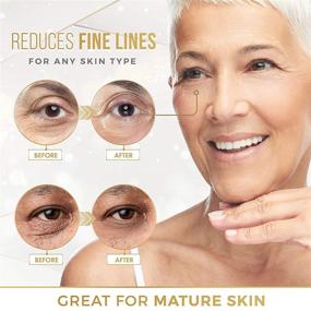 img 1 attached to Revitalize and Refresh Your Skin with 24K Gold Eye Mask – Reduce Puffy Eyes, Dark Circles, Wrinkles, and Fine Lines – Look Less Tired with 20 Pairs!