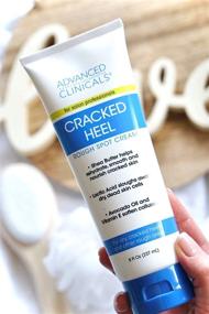 img 2 attached to 👣 Advanced Clinicals Cracked Heel Cream: Heal Dry Feet, Smooth Rough Spots, Banish Calluses (Two - 8oz)