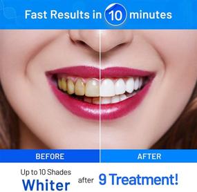 img 3 attached to 🦷 Non-Sensitive Teeth Whitening Pen: Effective Gel for Whiter Teeth, Easy-to-Use Kit with 20+ Uses, Painless and Natural Solution, Removes Stains from Smoking, Coffee, Soda