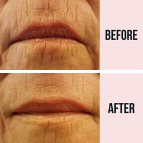 img 3 attached to 💋 Sio Beauty Super LipLift: Overnight Smoothing Patches for Lip & Smile Wrinkles