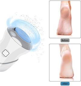 img 2 attached to 🦶 Rechargeable Electric Foot Callus Remover - KVISTER Heel Scraper for Feet, Dead Skin Remover with 2 Speeds & 3 Grinding Heads