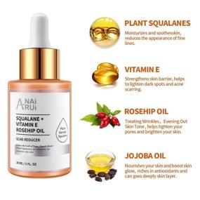 img 1 attached to 🌹 Scar-Reducing Squalane + Vitamin E Rosehip Oil Facial Moisturizer: Hydration and Reduction of Acne Scars, Stretch Marks, Wrinkles - for Softer, Smoother Skin | 1 fl. Oz.