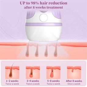 img 2 attached to 🔥 Revolutionary TUMAKOU Painless Permanent Hair Removal Device - Upgraded 999,999 Flashes for Wholebody Home Use - Unisex Hair Remover System