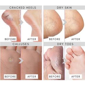 img 2 attached to Revive and Renew Your Feet with Foot Peel Mask - 2 Pack Peeling Mask for Cracked Heels & Calluses. Experience the Power of Natural Exfoliation and Dead Skin Removal for Guaranteed Baby Smooth Feet. Discover the Best Heel Peel to Repair and Remove Dead Rough Skin!