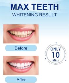 img 3 attached to 🌟 MySmile Teeth Whitening Kit with LED Light: Non-Sensitive Max Whitener with Carbamide Peroxide Pen - Remove Stains from Coffee, Smoking, Wine in just 10 Minutes!