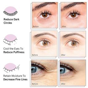 img 2 attached to 24 Pairs of Pink Gel Under-Eye Patches by grace and stella - Vegan, Cruelty-Free Self Care to Reduce Dark Circles, Puffy Eyes, Undereye Bags, and Wrinkles