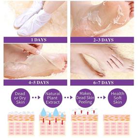 img 1 attached to 👣 2021 Newest & Effective Foot Peel Mask - 5 Pack for Callus and Dry Dead Skin, Dry Cracked Feet, Feet Peeling Mask With Lavender and Aloe Vera Gel for Men and Women