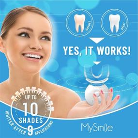 img 3 attached to 😃 Teeth Whitening Kit with LED Light, 10-Minute Non-Sensitive Fast Whitener - Includes 3 Carbamide Peroxide Gel Syringes. Effortlessly Erase Stains from Coffee, Smoking, Wines, Soda, and Food.