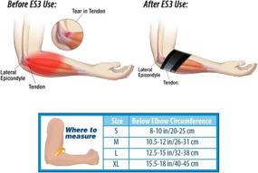 img 1 attached to 🎾 OrthoSleeve ES6 Elbow Bracing Sleeve (One Sleeve): Relieve Tennis & Golfer's Elbow, Pain from Arthritis & General Elbow, Reduce Swelling and Forearm Discomfort