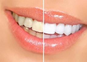 img 3 attached to 😁 Гелевые ручки для отбеливания зубов Smilebriter: органические, мягкие и эффективные - без вредных добавок! Поддерживает здоровье полости рта с мятным вкусом.