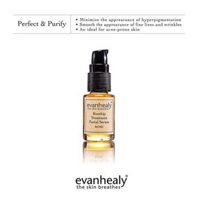 img 1 attached to 🌹 evanhealy Rosehip Facial Serum - Healing & Nourishing Solution for Damaged & Sensitive Skin