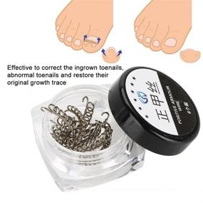 img 3 attached to Nail Corrector Pedicure Tool 12Pcs/Box - Effective Ingrown Wire Fixer for Toenail Correction & Recovery; 6 Sizes - Foot Care at its Finest