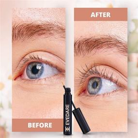 img 1 attached to 💁 EVEDARE Enhanced Eyelash Growth Serum - Advanced Formula with Peptides, Botanical Vitamins for Longer, Thicker, Fuller Lashes - Natural Extracts Improve Strength & Reduce Brittleness (3ML)