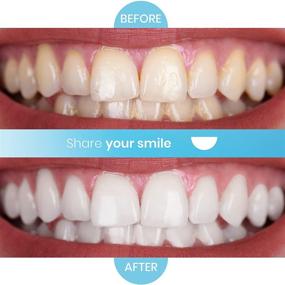 img 1 attached to Purean Oxystrips Teeth Whitening - 40 Atomic Oxygen Releasing White Strips - 20 Treatments