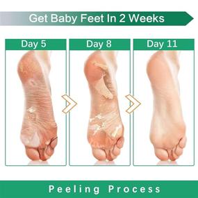 img 1 attached to Revive Your Feet with our Original Foot Peel Mask: Eliminate Cracked Heels, Dead Skin & Calluses - Effortlessly Repair with Natural Ingredients - Experience Smooth & Soft Feet - 2 Pairs for Women & Men!