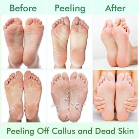 img 2 attached to 👣 Lavender & Aloe Vera Foot Peel Mask: 5 Pack for Dry, Cracked Feet - Effective Callus Remover & Exfoliator for Men and Women