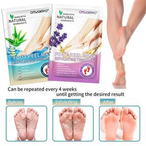 img 1 attached to 👣 Lavender & Aloe Vera Foot Peel Mask: 5 Pack for Dry, Cracked Feet - Effective Callus Remover & Exfoliator for Men and Women