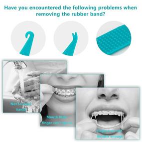 img 1 attached to 🦷 Резиновые кольца для зубных плетей - 8 шт, пластиковые ортодонтические резинки разных цветов