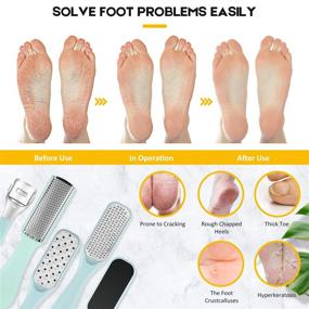 img 2 attached to 👣 Pedicure Foot File Tools Kit - Professional Callus Remover for Feet, Double-sided Hard Dead Skin Shaver - Home & Professional Wet Dry Use - Best Gift for Family, Friends, Men, Women - Complete Foot Care Set+