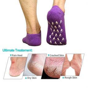 img 1 attached to 🧦 EXPER Moisturizing Gel Socks: Ultimate Solution for Dry, Cracked Heels & Broken Skin (Purple + Black)