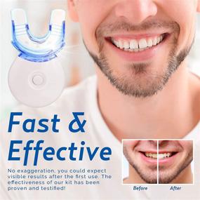 img 3 attached to ✨ AsaVea Teeth Whitening Kit with LED Light - Advanced Gel and High-Powered Light to Eradicate Stains - Set of 3 Teeth Whitening Gel, 1 Desensitizing Gel, Effortless and Gentle on Teeth