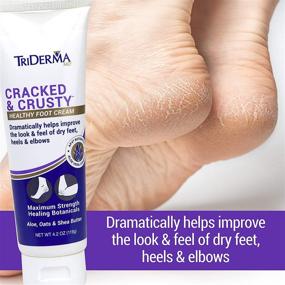 img 1 attached to TriDerma Cracked Crusty Healthy Cream