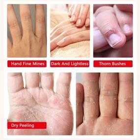 img 2 attached to Hydrating Hand Spa: 4 Pack Moisturizing Gloves Infused with Collagen, Serum, Vitamins, and Natural Extracts for Repairing Dry, Cracked Hands in Women & Men