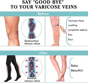 img 3 attached to 🩲 20-30mmHg Compression Stockings for Women with Varicose Veins