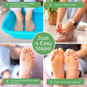 img 1 attached to Маска для ног Plantifique Foot Peel 2 Pack - Дерматологически протестирована, восстанавливает трещины на пятках, удаляет мёртвую кожу - естественное средство для обновления кожи ног и мягкости - Персиковая маска для обновления кожи ног.