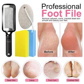 img 1 attached to Professional Pedicure Kit, Stainless Steel Heel Scraper for Women's Feet Care, Foot Pumice Stone for Hard Skin Remover in the Shower, Pumice Stone and Brush for Feet Callus Removal at Home or Salon