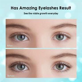 img 3 attached to 💁 Enhance Eyelash and Eyebrow Growth with SoftKare Natural Lash & Brow Growth Serum - Rapidly Grow Lashes for Women