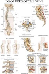 img 4 attached to Disorders Spine Anatomy Poster Anatomical