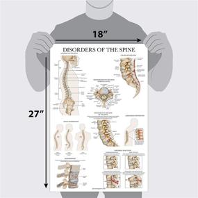 img 3 attached to Disorders Spine Anatomy Poster Anatomical