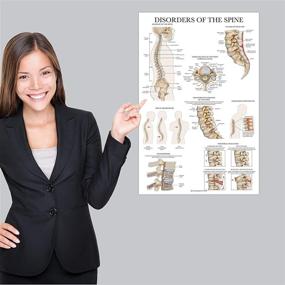 img 1 attached to Disorders Spine Anatomy Poster Anatomical