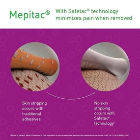 img 2 attached to 🩹 Mepitac 298300 Soft Silicone Tape – Versatile and Gentle Adhesive Tape for Wounds, Scars, and Medical Care