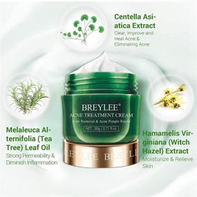 img 3 attached to BREYLEE Tea Tree Oil Acne Treatment Cream | Clear Severe Acne, Breakouts, and Remove Pimples | Repair Skin | 20ml, 0.7oz