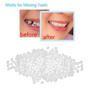 img 2 attached to 🦷 Versatile Temporary Tooth Repair Kit: Moldable Thermal Fitting Beads for Snap On Smile, Denture Adhesive, Fake Teeth, Cosmetic Braces, Veneer - Boost Confidence Instantly!