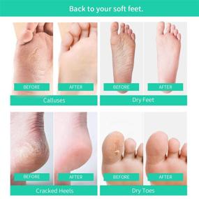 img 3 attached to 👣 Mixbeauty Exfoliating Foot Peel Mask - 2 Pack, Moisturizing Treatment for Cracked Heels, Dry Feet & Dead Skin Removal | Deep Repair & Get Baby Smooth Feet | Lavender Scented | Includes 2 Pairs/Box