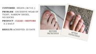 лечение ногтей drs. kline + green clear + restore - 3 месяца | приобретите раствор 0,90 унции сегодня логотип