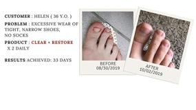 img 4 attached to Лечение ногтей Drs. Kline + Green Clear + Restore - 3 месяца | Приобретите раствор 0,90 унции сегодня