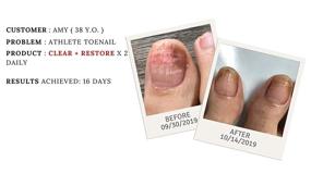 img 2 attached to Лечение ногтей Drs. Kline + Green Clear + Restore - 3 месяца | Приобретите раствор 0,90 унции сегодня