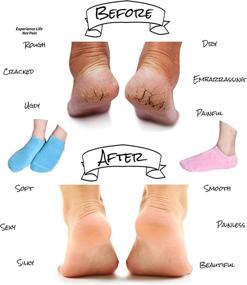 img 2 attached to 🧦 Soft Moisturizing Gel Socks with Essential Oils and Vitamins for Repairing Dry Cracked Feet Skins (Blue&amp;Pink)